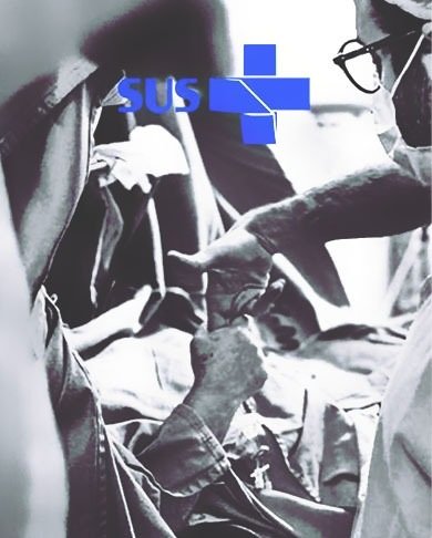 Photo documenting an Awake Brain Surgery procedure performed in Brazil's Public Health System (SUS)
